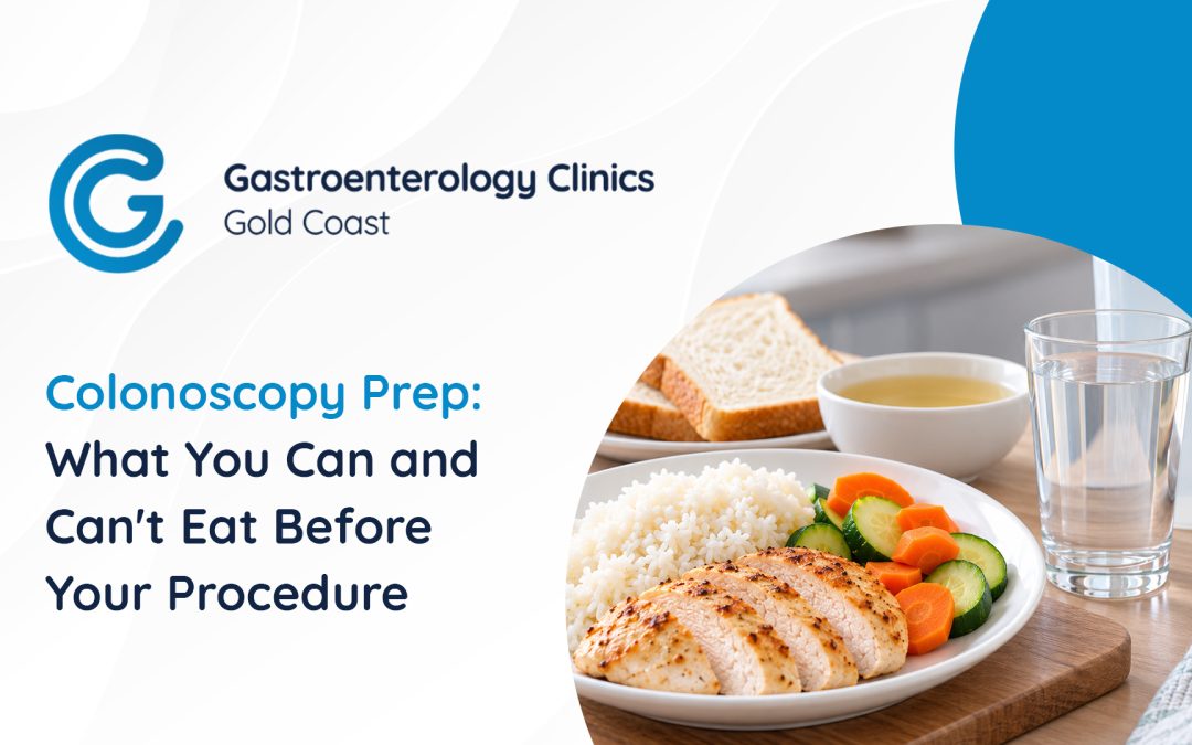 Colonoscopy Prep: What You Can and Can’t Eat Before Your Procedure