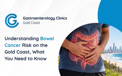 Understanding Bowel Cancer Risk on the Gold Coast, What You Need to Know